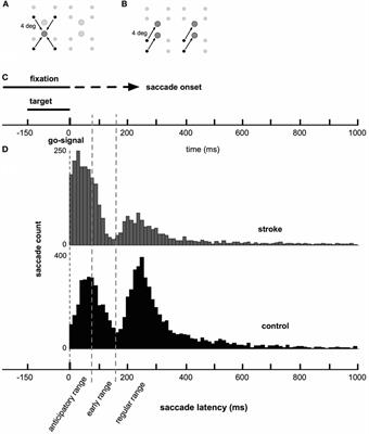 Disrupted Saccade Control in Chronic Cerebral Injury: Upper Motor Neuron-Like Disinhibition in the Ocular Motor System